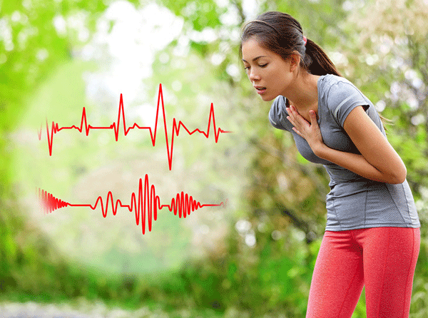 causes of palpitations is arrhythmias. These irregular heartbeats can result from electrical disturbances in the heart's normal conduction system.